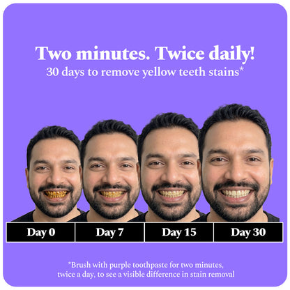 Perfora | Magic Whitening Toothpaste